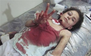 Wounded Syrian Child Asks for Peace